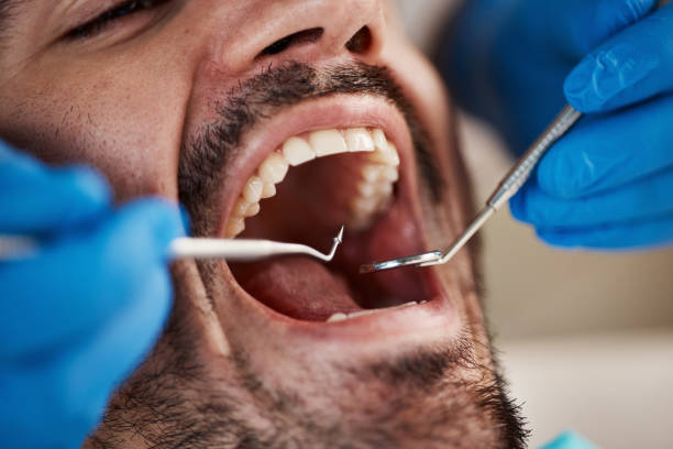 Best Emergency TMJ Treatment in Mooreland, OK