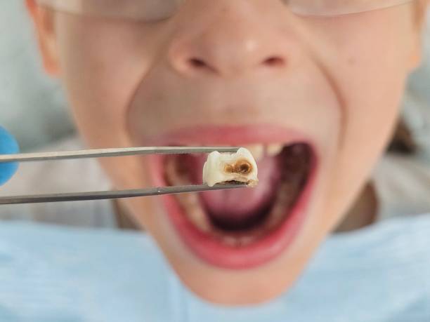 Best Same-Day Emergency Dental Services in Mooreland, OK