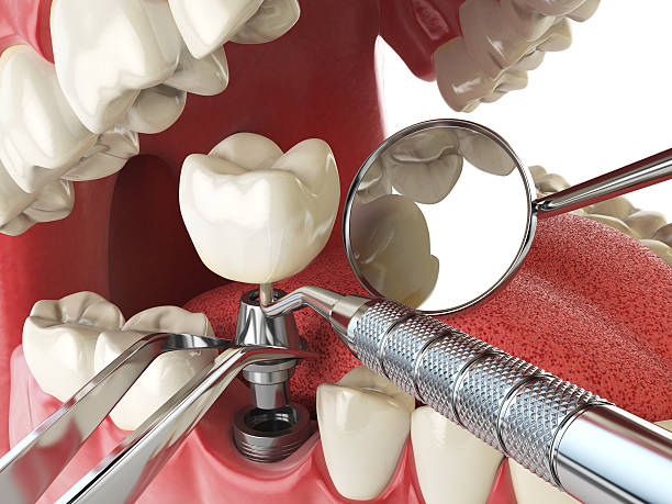 Best Same-Day Emergency Dental Services in Mooreland, OK